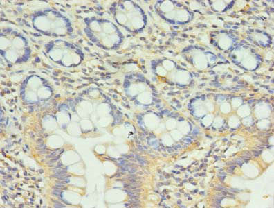 Immunohistochemistry of paraffin-embedded human small intestine tissue using CCDC57 Antibody at dilution of 1:100