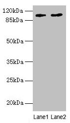 Western blot  | All lanes: CCDC57 antibody at 1.2µg/ml  | Lane 1: PC-3 whole cell lysate  | Lane 2: HepG2 whole cell lysate  | Secondary  | Goat polyclonal to rabbit IgG at 1/10000 dilution  | Predicted band size: 104, 86 kDa  | Observed band size: 104 kDa
