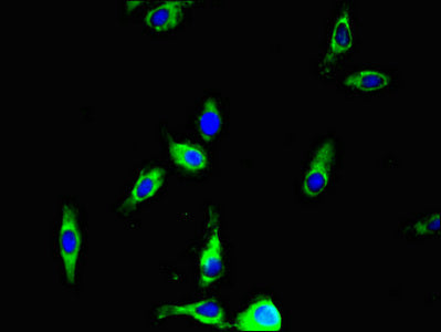 Immunofluorescent analysis of Hela cells using ANO4 Antibody at dilution of 1:100 and Alexa Fluor 488-congugated AffiniPure Goat Anti-Rabbit IgG(H+L)Rabbit anti-Human ANO4 Polyclonal Antibody