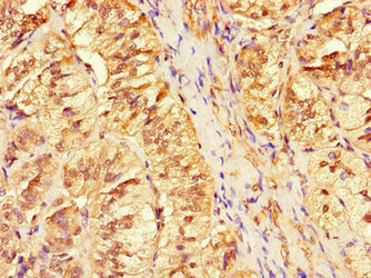 Immunohistochemistry of paraffin-embedded human adrenal gland tissue using ANO4 Antibody at dilution of 1:100Rabbit anti-Human ANO4 Polyclonal Antibody