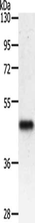 Gel: 10%SDS-PAGE, Lysate: 50 μg, Lane: Mouse heart tissue, Primary antibody: PDK2 Antibody(PDK2 Antibody) at dilution 1/500, Secondary antibody: Goat anti rabbit IgG at 1/8000 dilution, Exposure time: 1 minuteRabbit anti-Human PDK2 Polyclonal Antibody