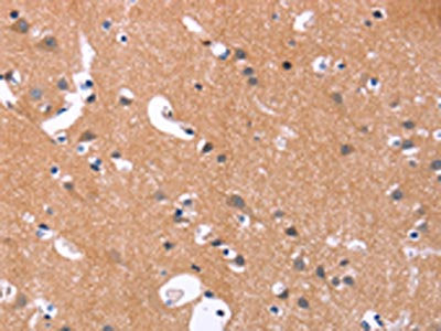 The image on the left is immunohistochemistry of paraffin-embedded Human brain  tissue using MAPK11 Antibody(MAPK11  Antibody) at dilution 1/30, on the right is treated with synthetic peptide. (Original magnification: ×200)Rabbit anti-Human MAPK11 Polyclonal Antibody