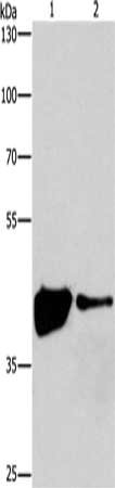 Gel: 8%SDS-PAGE, Lysate: 40 μg, Lane 1-2: 293T cells, human fetal brain tissue, Primary antibody: MAPK11 Antibody(MAPK11  Antibody) at dilution 1/200, Secondary antibody: Goat anti rabbit IgG at 1/8000 dilution, Exposure time: 30 secondsRabbit anti-Human MAPK11 Polyclonal Antibody