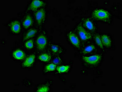 Immunofluorescent analysis of A549 cells using PLXND1 Antibody at dilution of 1:100 and Alexa Fluor 488-congugated AffiniPure Goat Anti-Rabbit IgG(H+L)Rabbit anti-Human PLXND1 Polyclonal Antibody