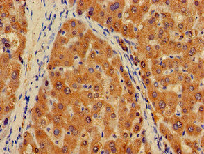 Immunohistochemistry of paraffin-embedded human liver tissue using the antibody at dilution of 1:100Rabbit anti-Human PLXND1 Polyclonal Antibody