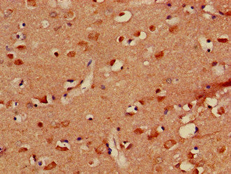 Immunohistochemistry of paraffin-embedded human brain tissue using PLXND1 Antibody at dilution of 1:100Rabbit anti-Human PLXND1 Polyclonal Antibody