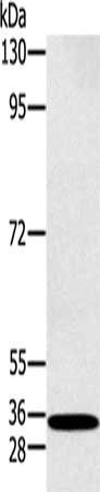 Gel: 8%SDS-PAGE, Lysate: 40 μg, Lane: K562 cells, Primary antibody: RAB27A Antibody(RAB27A Antibody) at dilution 1/400, Secondary antibody: Goat anti rabbit IgG at 1/8000 dilution, Exposure time: 30 secondsRabbit anti-Human RAB27A Polyclonal Antibody