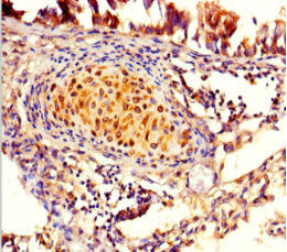 Immunohistochemistry of paraffin-embedded human lung tissue using FAM161A Antibody at dilution of 1:100Rabbit anti-Human FAM161A Polyclonal Antibody