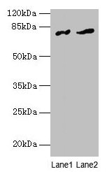 Western blot  | All lanes: FAM161A antibody at 8µg/ml  | Lane 1: Human placenta tissue  | Lane 2: Mouse liver tissue  | Secondary  | Goat polyclonal to rabbit IgG at 1/10000 dilution  | Predicted band size: 77, 65, 84 kDa  | Observed band size: 77 kDaRabbit anti-Human FAM161A Polyclonal Antibody