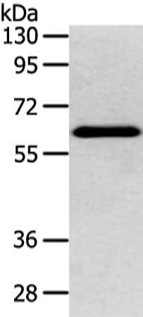 Gel: 8%SDS-PAGE, Lysate: 80 μg, Lane: Mouse brain tissue, Primary antibody: DHCR24 Antibody(DHCR24 Antibody) at dilution 1/400 dilution, Secondary antibody: Goat anti rabbit IgG at 1/8000 dilution, Exposure time: 5 secondsRabbit anti-Human DHCR24 Polyclonal Antibody