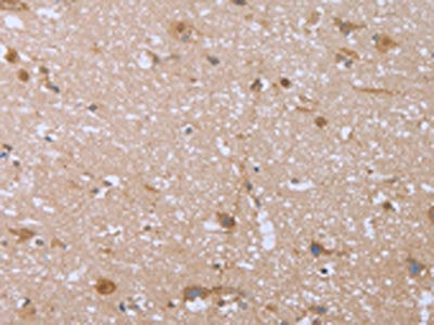 The image on the left is immunohistochemistry of paraffin-embedded Human brain  tissue using FHL2 Antibody(FHL2 Antibody) at dilution 1/40, on the right is treated with fusion protein. (Original magnification: ×200)Rabbit anti-Human FHL2 Polyclonal Antibody