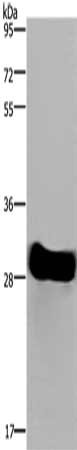 Gel: 8%SDS-PAGE, Lysate: 40 μg, Lane: Mouse heart tissue, Primary antibody: FHL2 Antibody(FHL2 Antibody) at dilution 1/1900, Secondary antibody: Goat anti rabbit IgG at 1/8000 dilution, Exposure time: 3 secondsRabbit anti-Human FHL2 Polyclonal Antibody