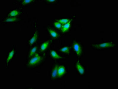 Immunofluorescence staining of Hela cells with SREBF2 Antibody at 1:66, counter-stained with DAPI. The cells were fixed in 4% formaldehyde, permeabilized using 0.2% Triton X-100 and blocked in 10% normal Goat Serum. The cells were then incubated with the antibody overnight at 4°C. The secondary antibody was Alexa Fluor 488-congugated AffiniPure Goat Anti-Rabbit IgG(H+L).Rabbit anti-Human SREBF2 Polyclonal Antibody