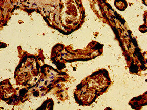 Immunohistochemistry of paraffin-embedded human placenta tissue using SREBF2 Antibody at dilution of 1:100Rabbit anti-Human SREBF2 Polyclonal Antibody