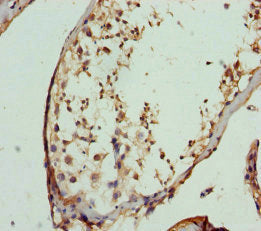 Immunohistochemistry of paraffin-embedded human testis tissue using FBXO7 Antibody at dilution of 1:100