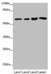 Western blot  | All lanes: FBXO7 antibody at 3.97µg/ml  | Lane 1: Mouse gonadal tissue  | Lane 2: Jurkat whole cell lysate  | Lane 3: 293T whole cell lysate  | Lane 4: PC-3 whole cell lysate  | Secondary  | Goat polyclonal to rabbit IgG at 1/10000 dilution  | Predicted band size: 59, 50, 46 kDa  | Observed band size: 59 kDa