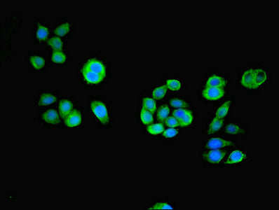 Immunofluorescent analysis of PC-3 cells using ACOT6 Antibody at dilution of 1:100 and Alexa Fluor 488-congugated AffiniPure Goat Anti-Rabbit IgG(H+L)