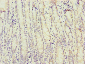 Immunohistochemistry of paraffin-embedded human small intestine tissue using MTERF2 Antibody at dilution of 1:100Rabbit anti-Human MTERF2 Polyclonal Antibody