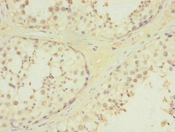 Immunohistochemistry of paraffin-embedded human testis tissue using MTERF2 Antibody at dilution of 1:100Rabbit anti-Human MTERF2 Polyclonal Antibody
