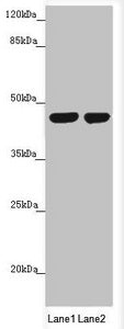 Western blot | All lanes: MTERFD3 antibody at 1.66 μg/ml | Lane 1: U251 whole cell lysate | Lane 2: HepG2 whole cell lysate | Secondary | Goat polyclonal to rabbit IgG at 1/10000 dilution | Predicted band size: 44 kDa | Observed band size: 44 kDaRabbit anti-Human MTERF2 Polyclonal Antibody