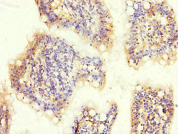 Immunohistochemistry of paraffin-embedded human small intestine tissue using MTERF2 Antibody at dilution of 1:100Rabbit anti-Human MTERF2 Polyclonal Antibody