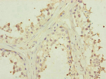 Immunohistochemistry of paraffin-embedded human testis tissue using MTERF2 Antibody at dilution of 1:100Rabbit anti-Human MTERF2 Polyclonal Antibody