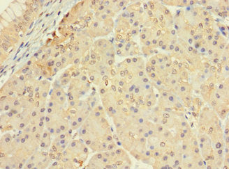 Immunohistochemistry of paraffin-embedded human pancreatic tissue using CERKL Antibody at dilution of 1:100Rabbit anti-Human CERKL Polyclonal Antibody