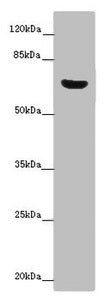 Western blot | All lanes: CERKL antibody at 14 μg/ml + Mouse lung tissue | Secondary | Goat polyclonal to rabbit IgG at 1/10000 dilution | Predicted band size: 63, 60, 53, 48, 43, 25, 20, 58 kDa | Observed band size: 63 kDaRabbit anti-Human CERKL Polyclonal Antibody