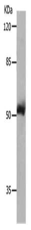 Gel: 8%SDS-PAGE, Lysate: 40 μg, Lane: 231 cells, Primary antibody: MMP8 Antibody(MMP8 Antibody) at dilution 1/800, Secondary antibody: Goat anti rabbit IgG at 1/8000 dilution, Exposure time: 10 secondsRabbit anti-Human MMP8 Polyclonal Antibody
