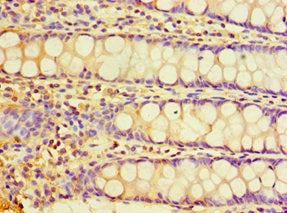 Immunohistochemistry of paraffin-embedded human colon tissue using CHRFAM7A Antibody at dilution of 1:100Rabbit anti-Human CHRFAM7A Polyclonal Antibody