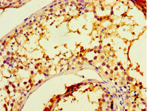 Immunohistochemistry of paraffin-embedded human testis tissue using CHRFAM7A Antibody at dilution of 1:100Rabbit anti-Human CHRFAM7A Polyclonal Antibody
