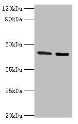 Western blot | All lanes: CHRFAM7A antibody at 3μg/ml | Lane 1: Jurkat whole cell lysate | Lane 2: Rat liver tissue | Secondary | Goat polyclonal to rabbit IgG at 1/10000 dilution | Predicted band size: 46 kDa | Observed band size: 46 kDaRabbit anti-Human CHRFAM7A Polyclonal Antibody