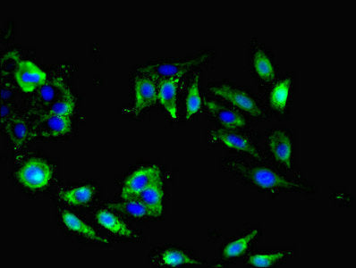 Immunofluorescent analysis of Hela cells using NRN1L Antibody at dilution of 1:100 and Alexa Fluor 488-congugated AffiniPure Goat Anti-Rabbit IgG(H+L)Rabbit anti-Human NRN1L Polyclonal Antibody