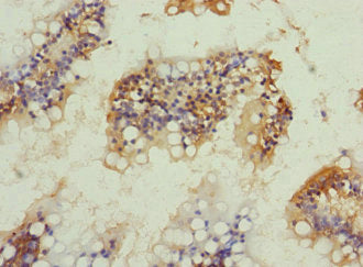 Immunohistochemistry of paraffin-embedded human small intestine tissue using NRN1L Antibody at dilution of 1:100Rabbit anti-Human NRN1L Polyclonal Antibody