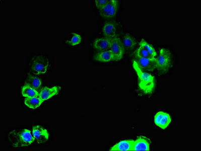 Immunofluorescent analysis of A431 cells using SLC36A2 Antibody at dilution of 1:100 and Alexa Fluor 488-congugated AffiniPure Goat Anti-Rabbit IgG(H+L)