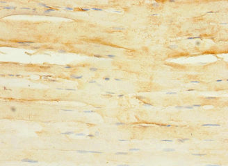 Immunohistochemistry of paraffin-embedded human skeletal muscle tissue using the antibody at dilution of 1:100