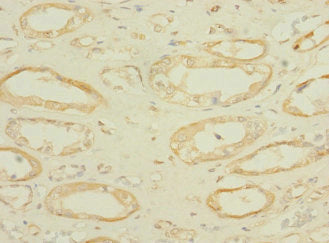 Immunohistochemistry of paraffin-embedded human kidney tissue using SLC36A2 Antibody at dilution of 1:100