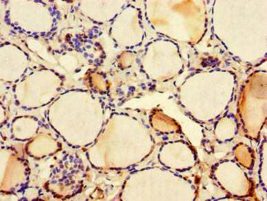 Immunohistochemistry of paraffin-embedded human thyroid tissue using C2CD3 Antibody at dilution of 1:100