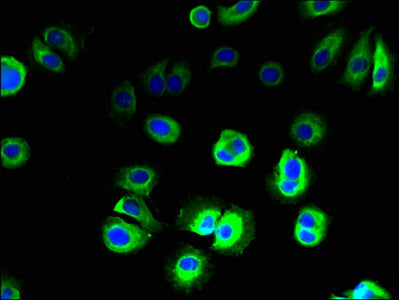 Immunofluorescent analysis of MCF-7 cells using SLC36A3 Antibody at dilution of 1:100 and Alexa Fluor 488-congugated AffiniPure Goat Anti-Rabbit IgG(H+L)Rabbit anti-Human SLC36A3 Polyclonal Antibody