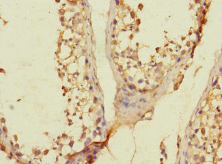 Immunohistochemistry of paraffin-embedded human testis tissue using the antibody at dilution of 1:100Rabbit anti-Human SLC36A3 Polyclonal Antibody