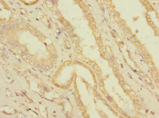 Immunohistochemistry of paraffin-embedded human kidney tissue using SLC36A3 Antibody at dilution of 1:100Rabbit anti-Human SLC36A3 Polyclonal Antibody