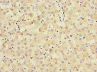 Immunohistochemistry of paraffin-embedded human liver tissue using TIMM50 Antibody at dilution of 1:100Rabbit anti-Human TIMM50 Polyclonal Antibody
