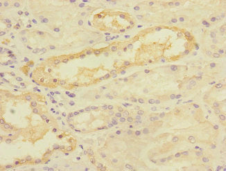Immunohistochemistry of paraffin-embedded human kidney tissue using TIMM50 Antibody at dilution of 1:100Rabbit anti-Human TIMM50 Polyclonal Antibody