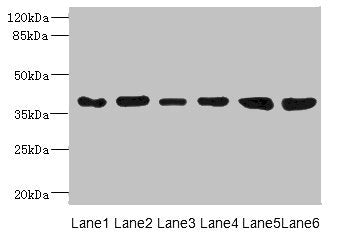 Western blot  | All lanes: TIMM50 antibody at 4.05µg/ml  | Lane 1: Rat heart tissue  | Lane 2: MM231 whole cell lysate  | Lane 3: MCF-7 whole cell lysate  | Lane 4: Hela whole cell lysate  | Lane 5: 293T whole cell lysate  | Lane 6: HepG2 whole cell lysate  | Secondary  | Goat polyclonal to rabbit IgG at 1/10000 dilution  | Predicted band size: 40, 51, 28 kDa  | Observed band size: 40 kDaRabbit anti-Human TIMM50 Polyclonal Antibody