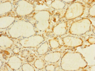 Immunohistochemistry of paraffin-embedded human thyroid tissue using C8orf34 Antibody at dilution of 1:100