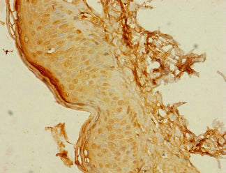 Immunohistochemistry of paraffin-embedded human skin tissue using C8orf34 Antibody at dilution of 1:100