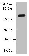 Western Blot  | All lanes: C8orf34 antibody at 5µg/ml + Mouse skeletal muscle tissue  | Secondary  | Goat polyclonal to rabbit IgG at 1/10000 dilution  | Predicted band size: 60, 48, 33, 23 kDa  | Observed band size: 60 kDa