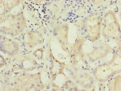 Immunohistochemistry of paraffin-embedded human kidney tissue using C5orf22 Antibody at dilution of 1:100