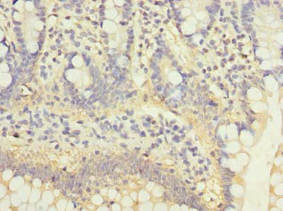 Immunohistochemistry of paraffin-embedded human small intestine tissue using C5orf22 Antibody at dilution of 1:100