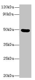 Western blot  | All lanes: C5orf22 antibody at 8µg/ml + Mouse brain tissue  | Secondary  | Goat polyclonal to rabbit IgG at 1/10000 dilution  | Predicted band size: 50, 21, 19 kDa  | Observed band size: 50 kDa